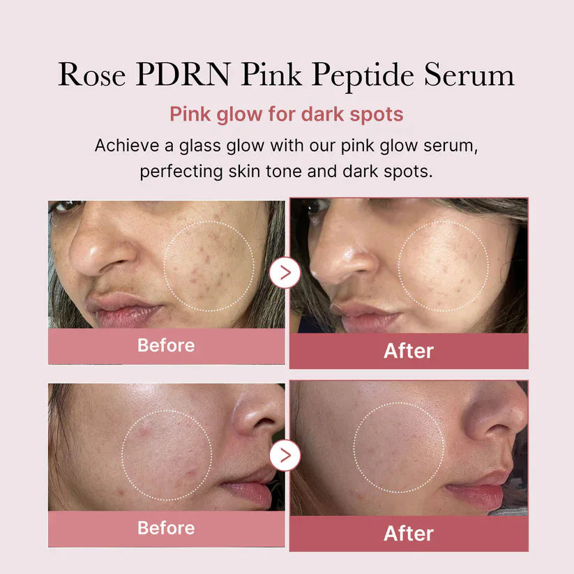 Pink Peptide Serum  Dark Spot Care Even Skin Tone Boosts Elasticity Smooth Firm Niacinamide Bright Essence Korean Makeup