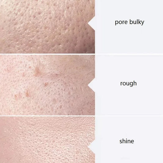 Facial Skincare Face Serum Hydro Aqua Peel Solution 400ml Kit of 3 Serums AS1 SA2 AO3 For Facial Machine Skin Deep Cleaning