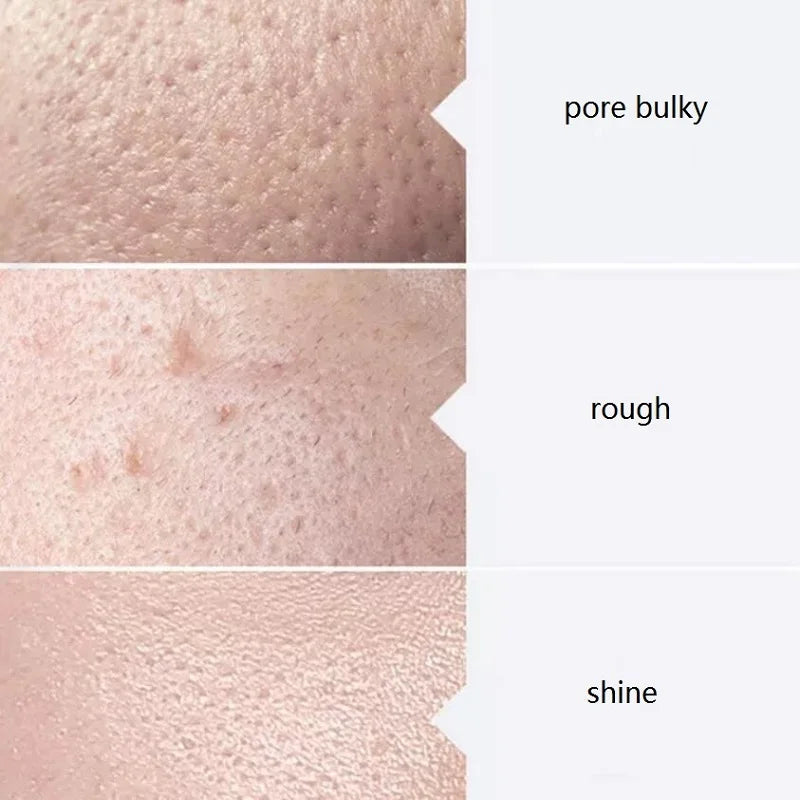 Facial Skincare Face Serum Hydro Aqua Peel Solution 400ml Kit of 3 Serums AS1 SA2 AO3 For Facial Machine Skin Deep Cleaning
