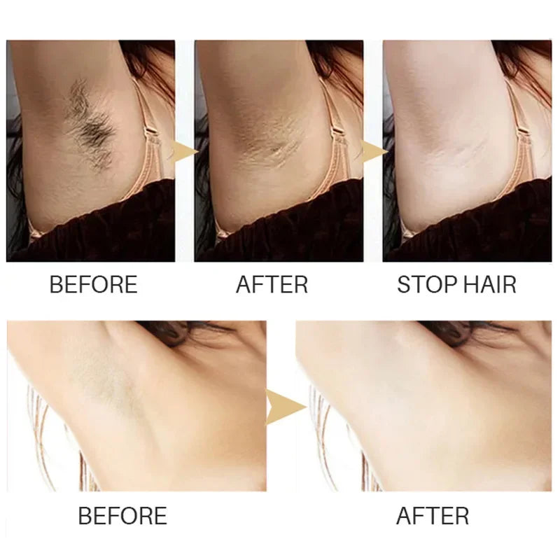 Permanent Hair Inhibition Serum Painless Hair Remover Armpit Legs Arms Hair Growth Inhibitor Depilatory Body Cream Care For Men