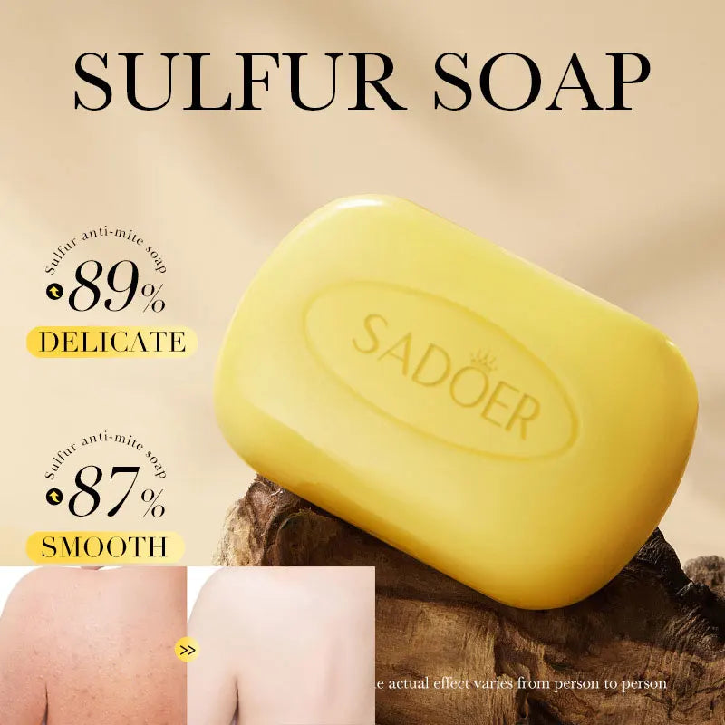 1Box Sulfur Anti Mite Soap Cleansing The Body Handmade Soap Turmeric Acid Kojico Foam Moisturize Control Oil and Prevent Dry