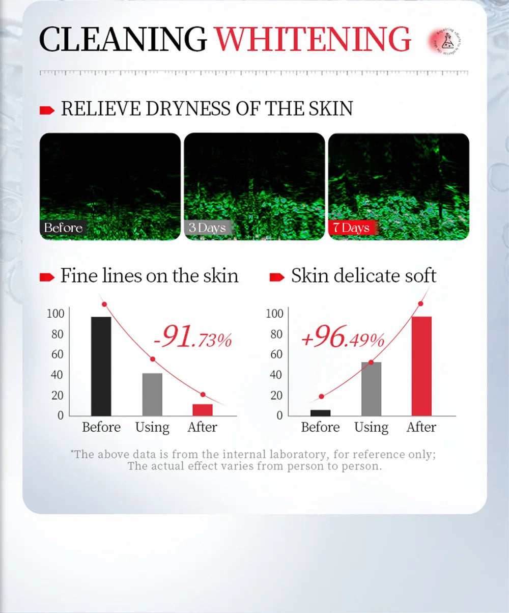 Kojic Acid Whitening Cleansing Soap, Facial And Body Soap Containing Niacinamide And Hyaluronic Acid, With A Foaming Net.