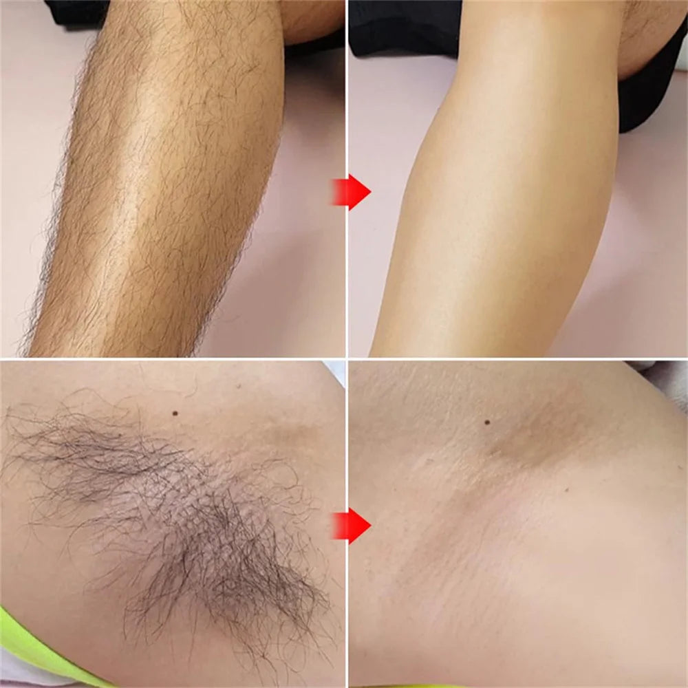 Permanent Hair Removal Cream Hair Growth Inhibitor Face Arm Armpit Leg Intimate Areas Painless Depilatory For Men Women Care