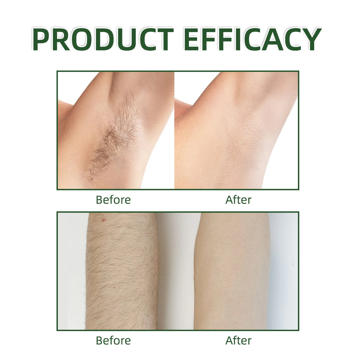 Permanent Hair inhibition Armpit Legs Arms Hair Growth Skin Care  Inhibitor Beauty Painless Hair Remover Body Essential Oil