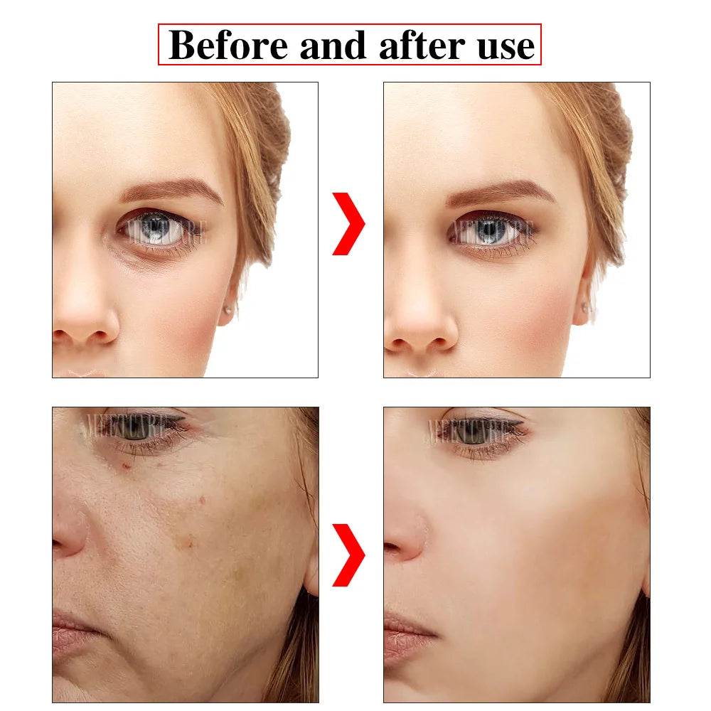 Hydra Derma Roller 64pin Microneedle Dermaroller With Serum Infusion for Lip Hair Face Scalp Beard  Beauty Skin Care