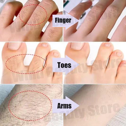 Painless Hair Removal Creams Fast Gentle Removal Skin Care Whitening Clear Lip Hair Underarm Depilation Cream Women Men Beauty