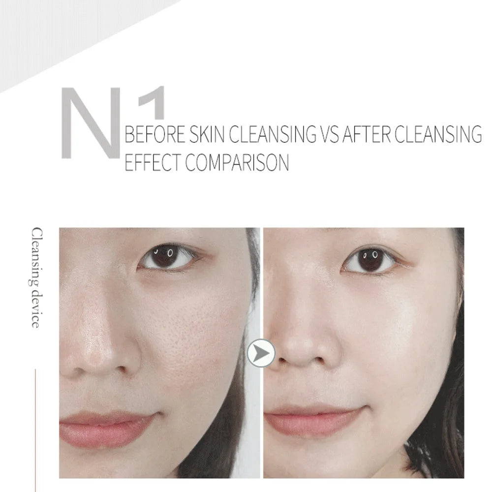 Hydra Bubble Skin Beauty Oxygen Facial Cleaning Ultrasonic Skin Scrubber Deep Face Cleaning Super Bubble Hydro Machine