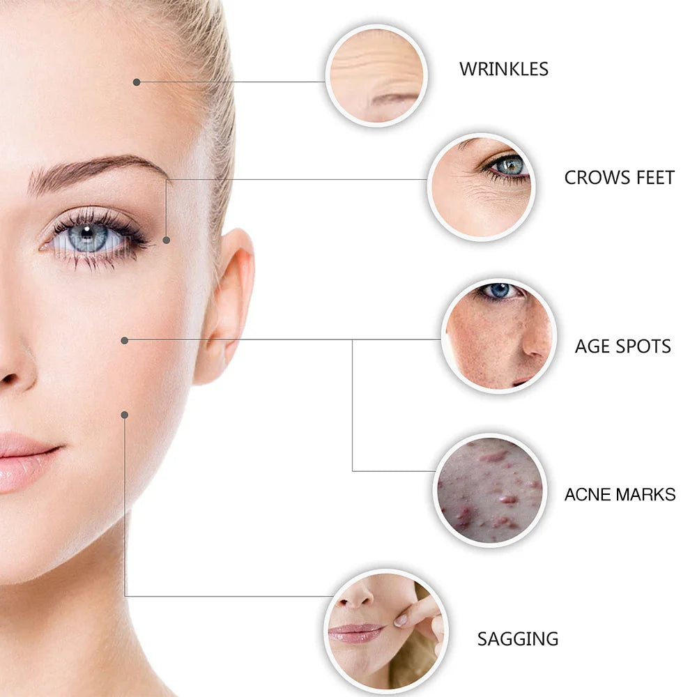Hydra Derma Roller 64pin Microneedle Dermaroller With Serum Infusion for Lip Hair Face Scalp Beard  Beauty Skin Care