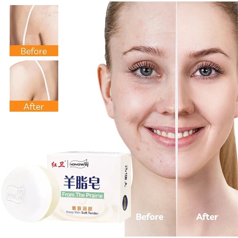 Cleans Moisturizes Skin Lanolin Soap Facial Soap Rich Foam Easy Rinse Gentle Clean Bath Two-in-one Oil-control Double-sided Soap