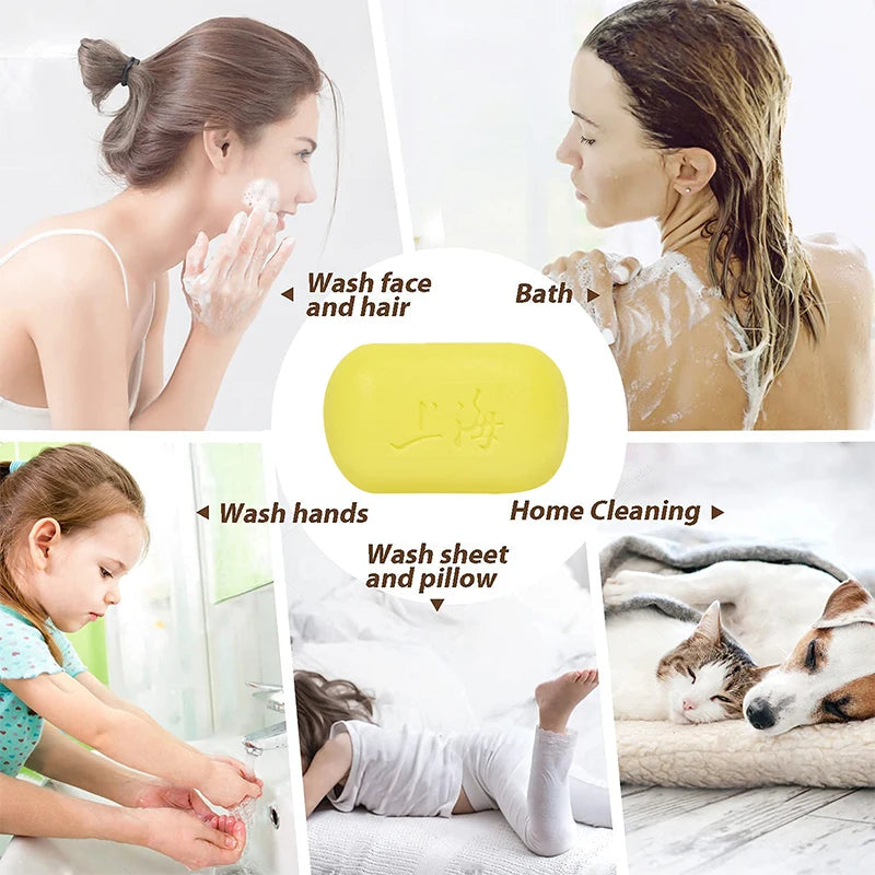 3/5Pcs Shanghai Sulfur Soap Traditional Chinese Skin Care Oil-Control Acne Cover Cleanser For Healthy Glowing Skin