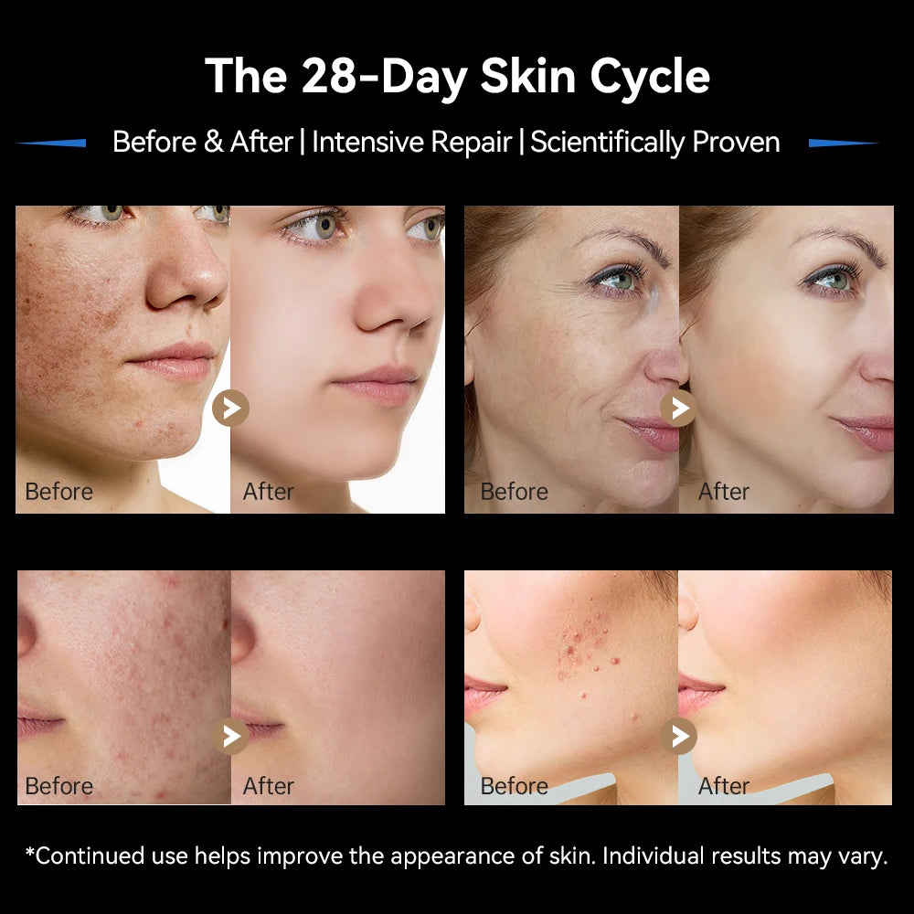 Professional Dr.pen M9 Microneedle Device With Hello Face M300 LED Mask Beauty machine Needle length 0.25 mm