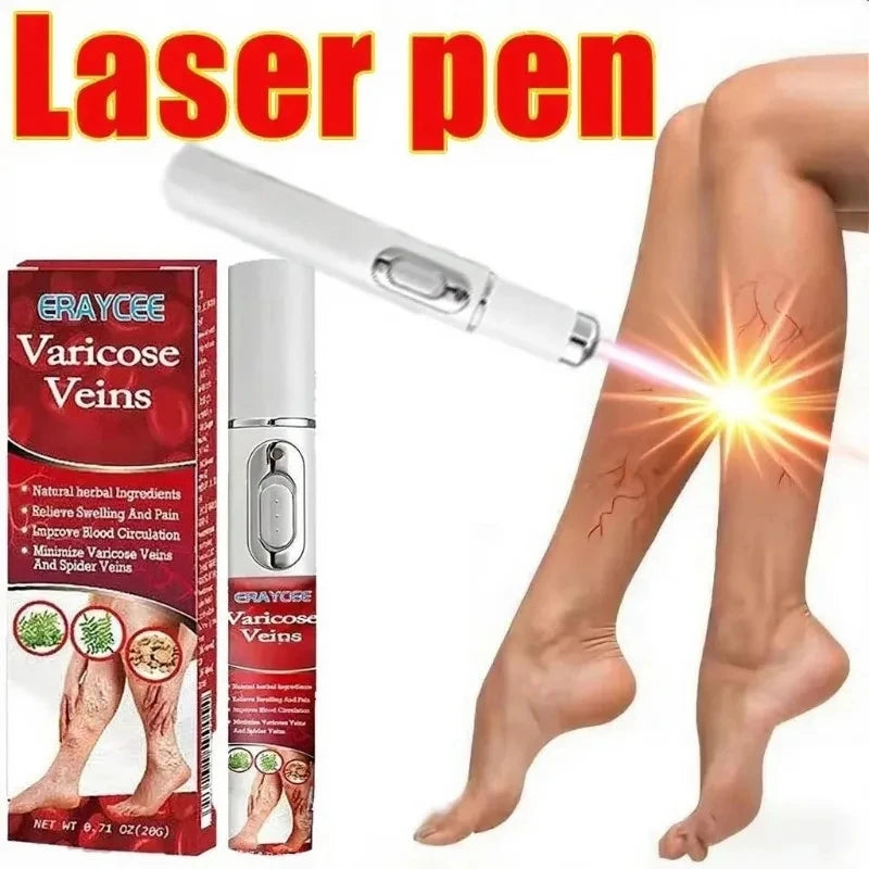 Stylo Laser pour abat-jour, outil pour varices, soulagement efficace de la vascularite dilatée dans les jambes, phlébite, amélio