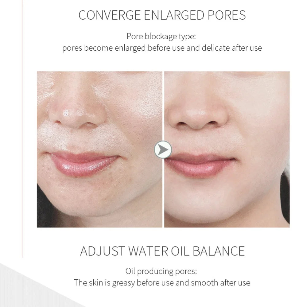 Hydra Bubble Skin Beauty Oxygen Facial Cleaning Ultrasonic Skin Scrubber Deep Face Cleaning Super Bubble Hydro Machine