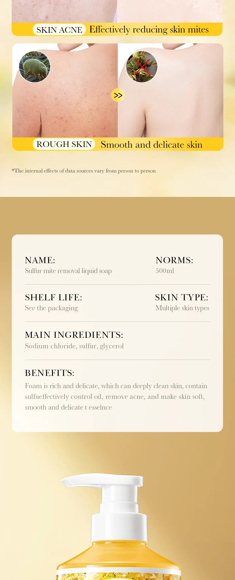 500ml Deep Cleansing Sulfur Mite Removal Body Wash Oil Control Shower Gel  Bath and Body Cleansers