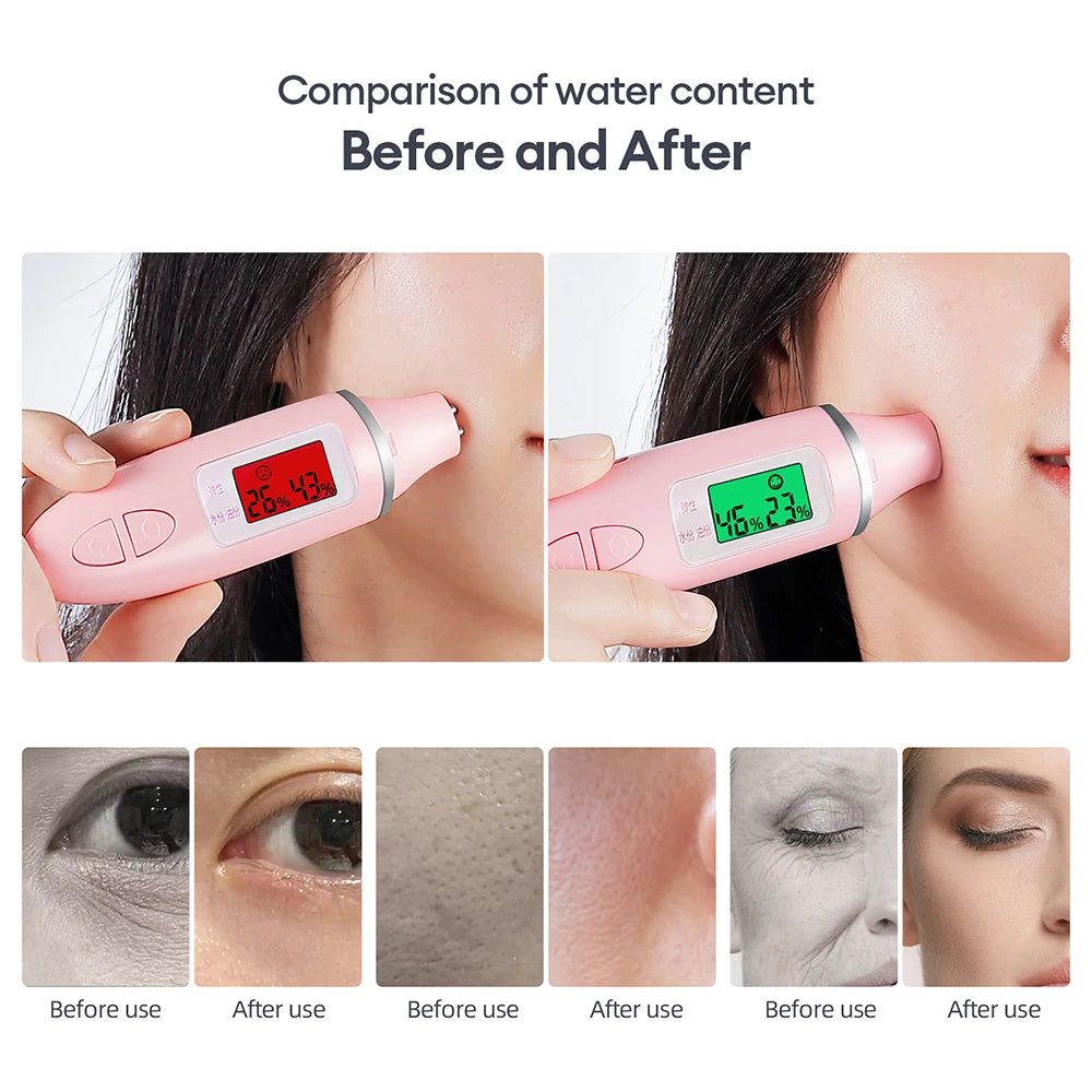 CO2 Bubble Oxygen Beauty Machine Facial SPA Oxygen Bubble Pen CO2 Oxygen Portable Facial Machine CO2 Gel Facial Skin Care Device