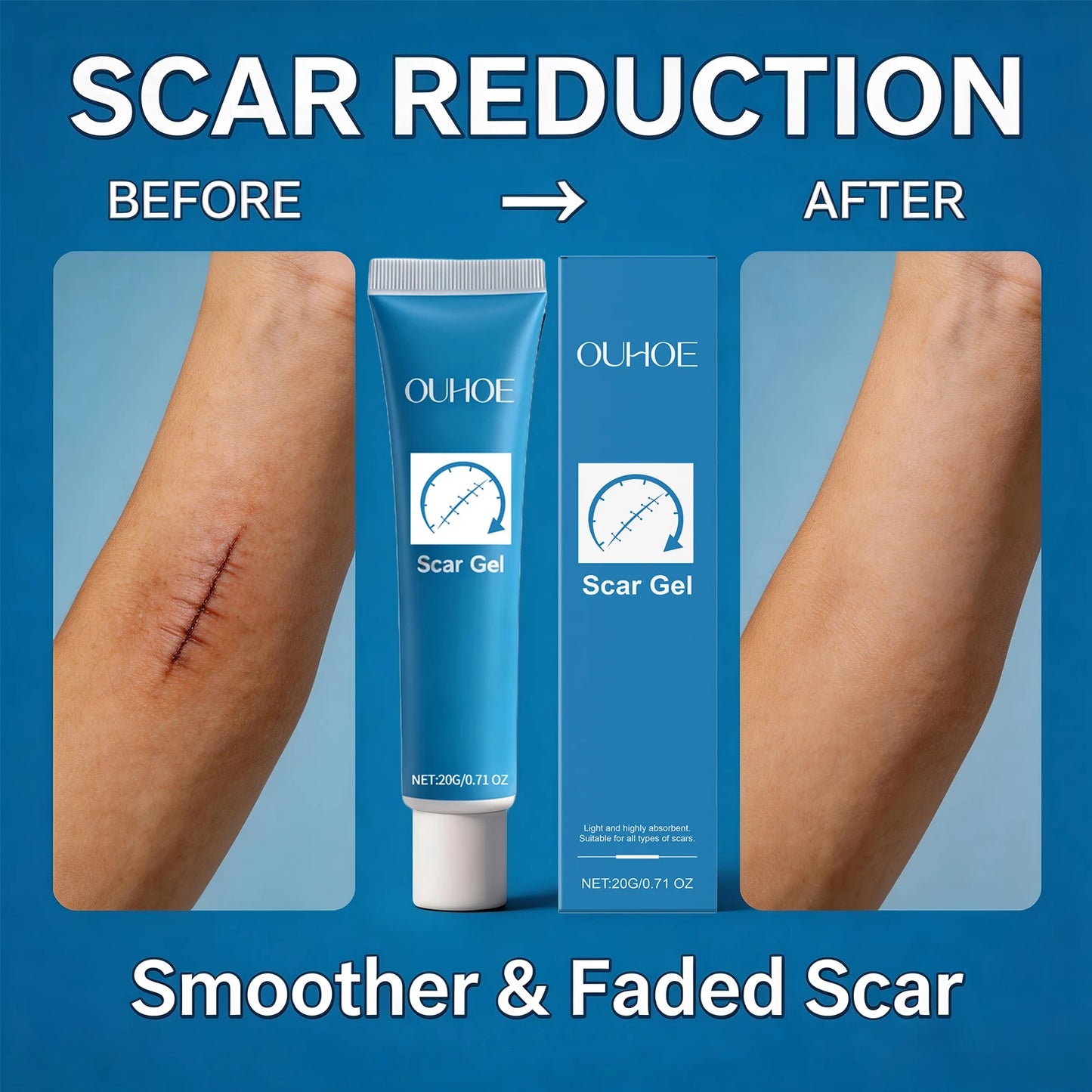 Ouhoe Scar Gel Scar Repair Cream Fade-Out Scald Scar Skin Wound Cream Stretch Marks Acne Marks Repair Gel Skin Care Products