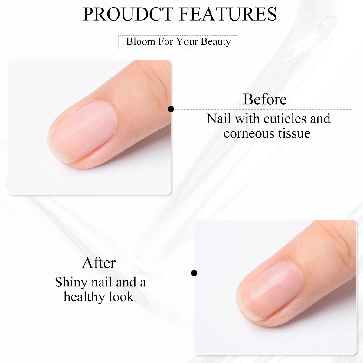 7ml Nail Cuticle Softener Remover Softener Exfoliator Cuticle Oil Nail Treatment Manicure Soften Dead Skin Nourishing Nails Care