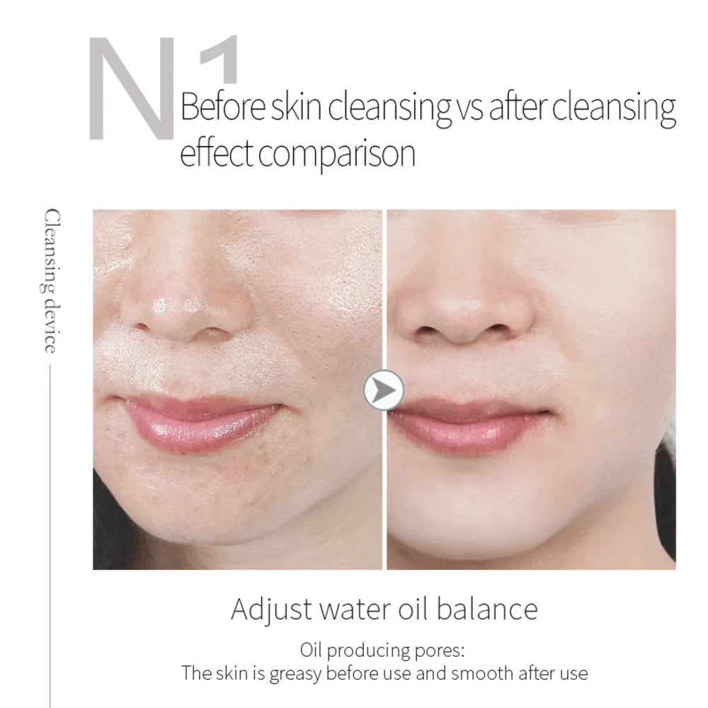 Hydra Bubble Skin Beauty Oxygen Facial Cleaning Ultrasonic Skin Scrubber Deep Face Cleaning Super Bubble Hydro Machine