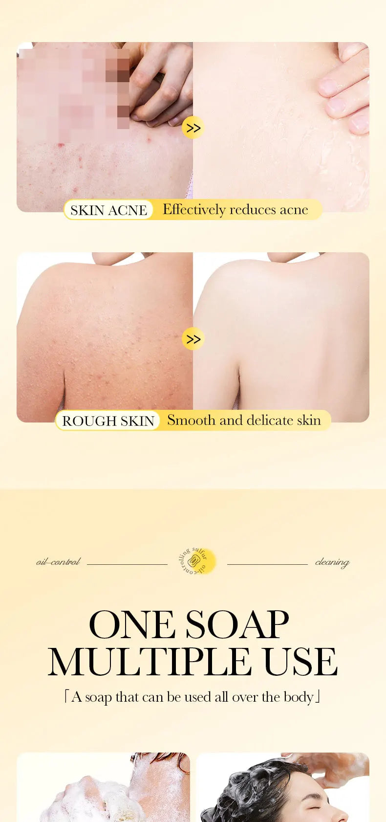 1Box Sulfur Anti Mite Soap Cleansing The Body Handmade Soap Turmeric Acid Kojico Foam Moisturize Control Oil and Prevent Dry