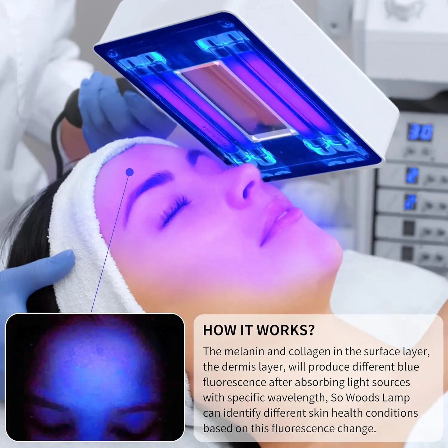 Woods Lamp Skin Analyzer,Magnifying Handle Woods-Lamp,UV Light for Facial Skin Analyze Facial Detector with Black Shade Cloth