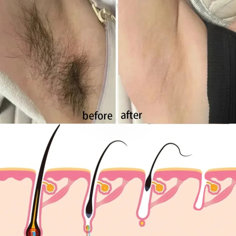 Permanent Hair Removal Cream Hair Growth Inhibitor Face Arm Armpit Leg Intimate Areas Painless Depilatory For Men Women Care