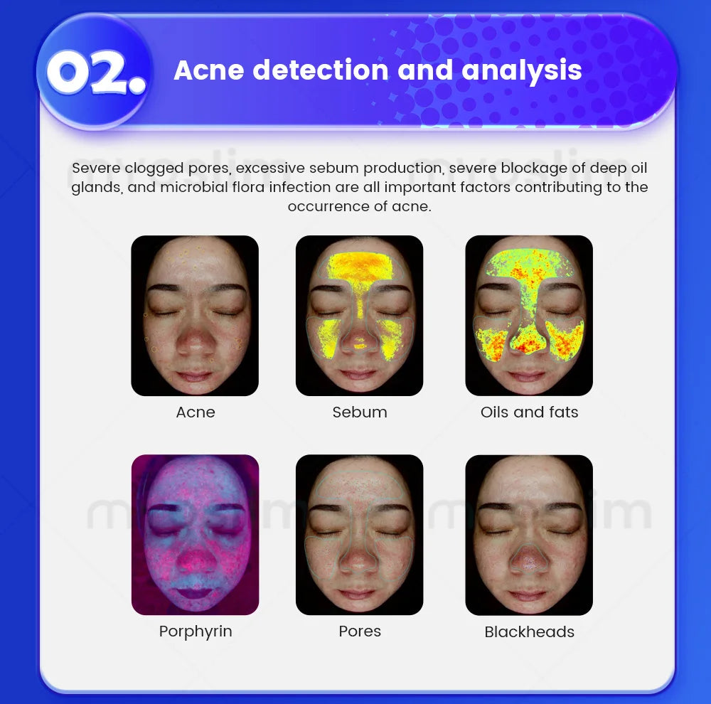 3D Facial Skin Analyzer Machine 21.5 Inch AI 8 Light Spectrum Skin Care Scanner Hair Analysis for Business Beauty Care