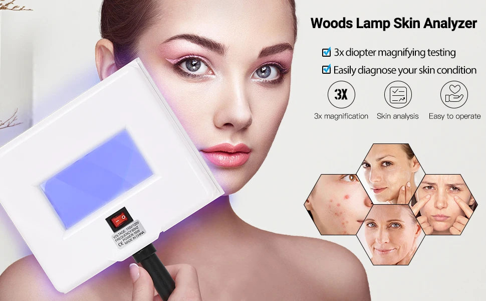 Woods Lamp Skin Analyzer,Magnifying Handle Woods-Lamp,UV Light for Facial Skin Analyze Facial Detector with Black Shade Cloth