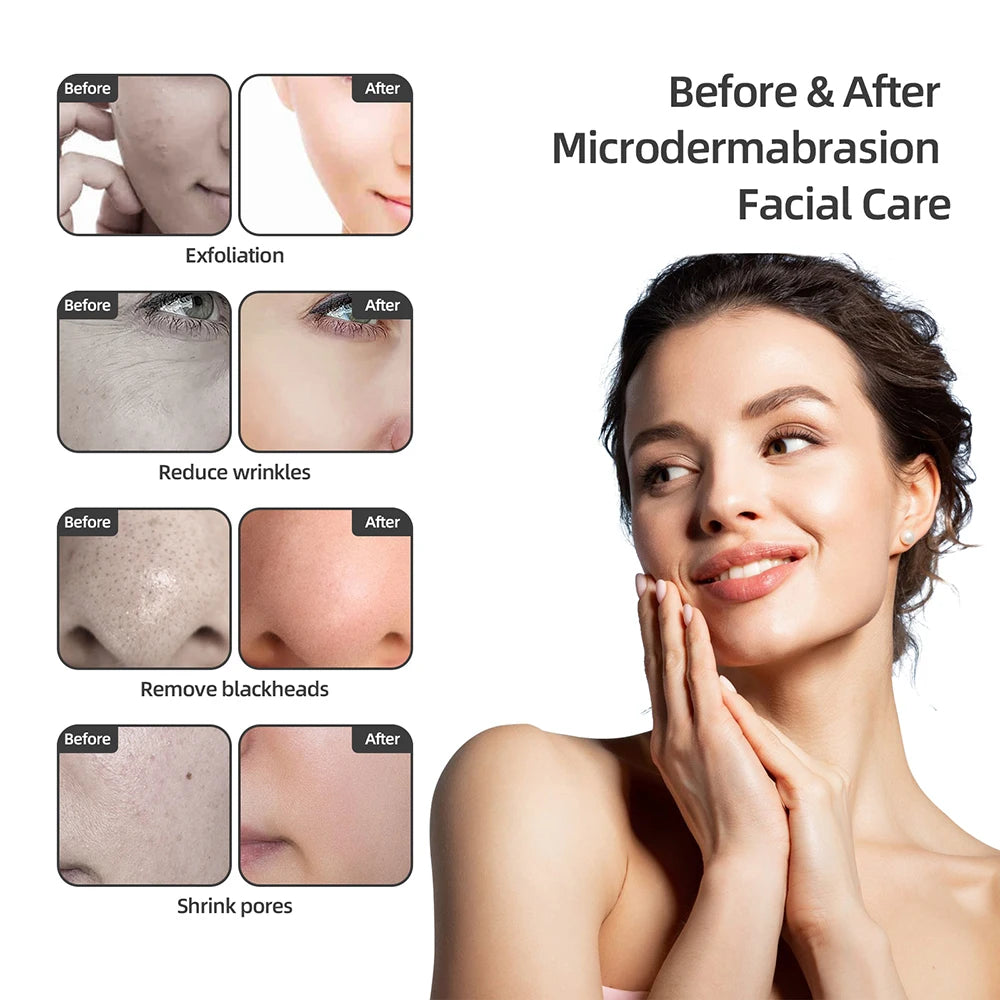 Spa Facial Peeling Deep Cleansing Device Face Beauty Machine Pore Deep Cleaning Skin Care