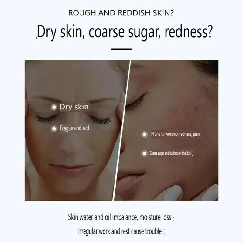 Moisturizing Hydrating Face Cream Redness Relief Cream Soothes Sensitive Skin Reduce Redness Skin Dryness Unisex Soothing Lotion
