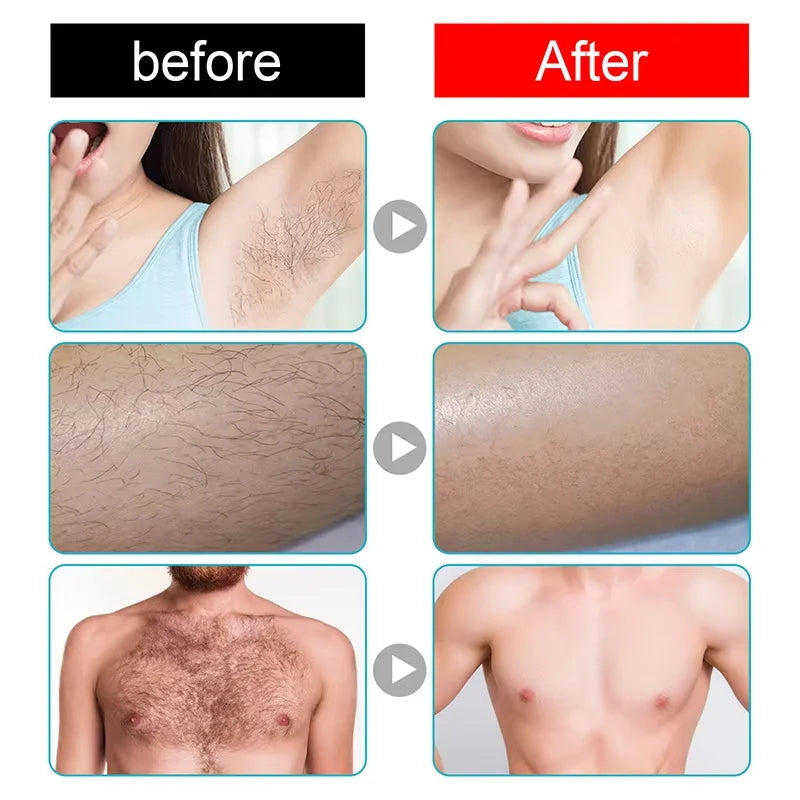 Permanent Hair Removal Cream Hair Growth Inhibitor Face Arm Armpit Leg Intimate Areas Painless Depilatory For Men Women Care