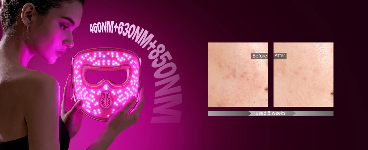 Professional Dr.pen M9 Microneedle Device With Hello Face M300 LED Mask Beauty machine Needle length 0.25 mm