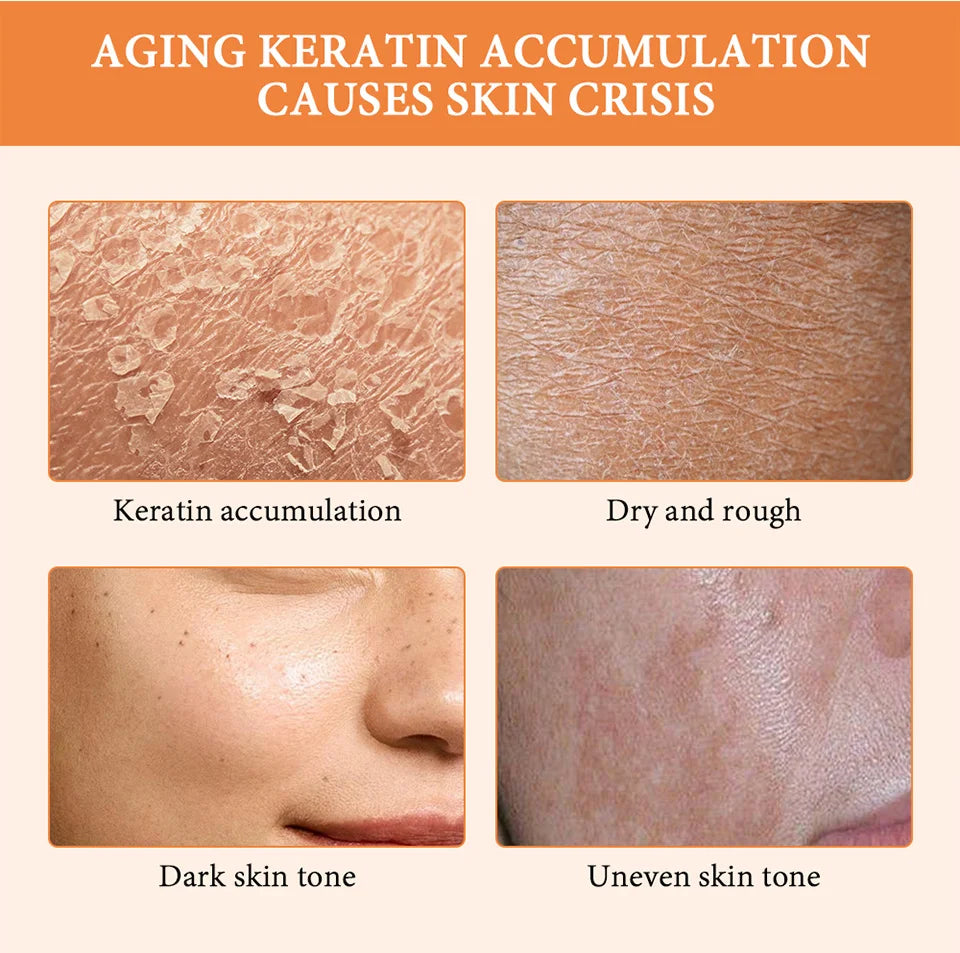 50ml Orange Exfoliateing Gel Dead Spot Remover Brighten Peeling Gentle Repair Scrub Whiten Hydrating Moisturizer Women Skin Care