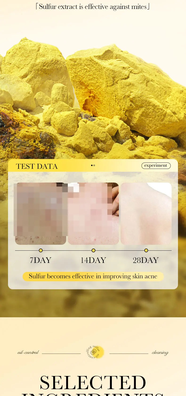 1Box Sulfur Anti Mite Soap Cleansing The Body Handmade Soap Turmeric Acid Kojico Foam Moisturize Control Oil and Prevent Dry