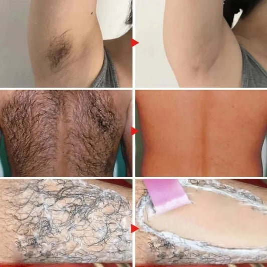Permanent Hair Removal Cream Hair Growth Inhibitor Face Arm Armpit Leg Intimate Areas Painless Depilatory For Men Women Care